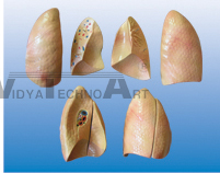 The dissection model of lung